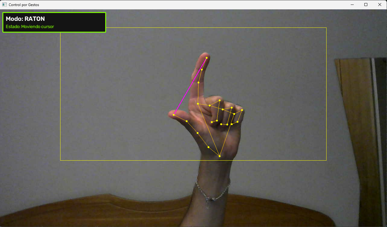 Artificial Vision